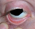 Click image for larger version

Name:	around-time-of-diagnosis.jpg
Views:	2290
Size:	372.0 KB
ID:	238095