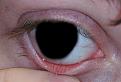 Click image for larger version

Name:	six-months-after-diagnosis.jpg
Views:	2239
Size:	365.4 KB
ID:	238096